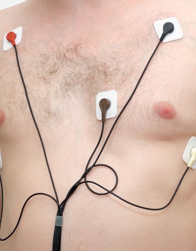 24 hr Holter Monitor